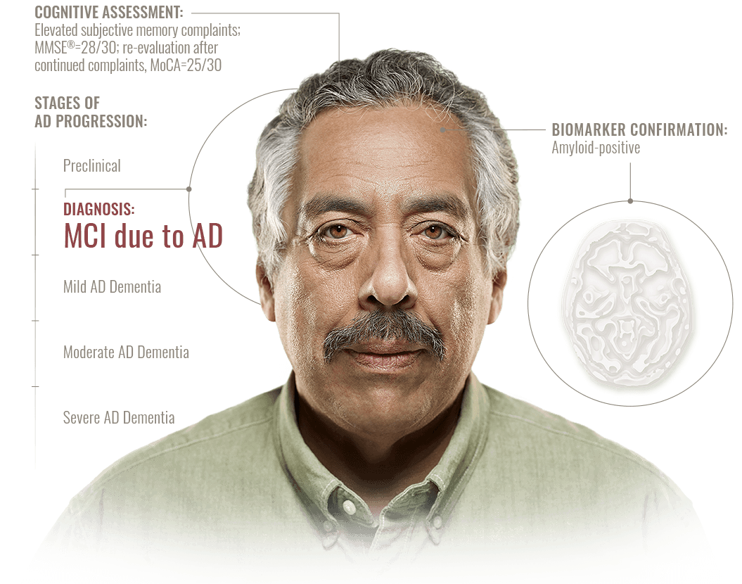 A visual representation of the cognitive assessment of a man with elevated subjective memory complaints, the timeline for the stages of Alzheimer's disease progression, and biomarker confirmation